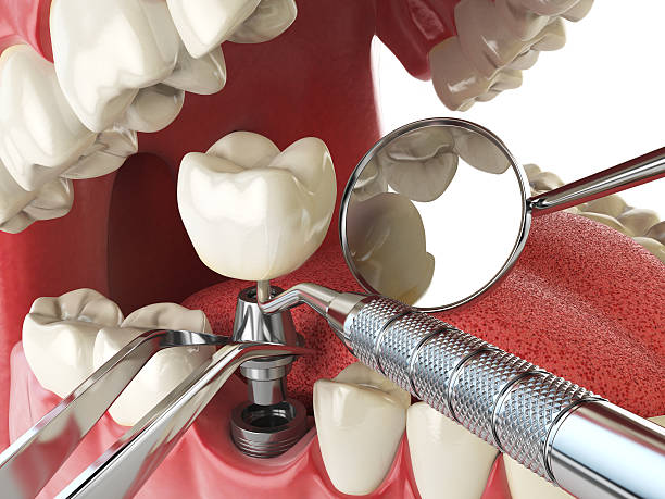 Best Emergency Gum Pain Relief  in Somerset, KY